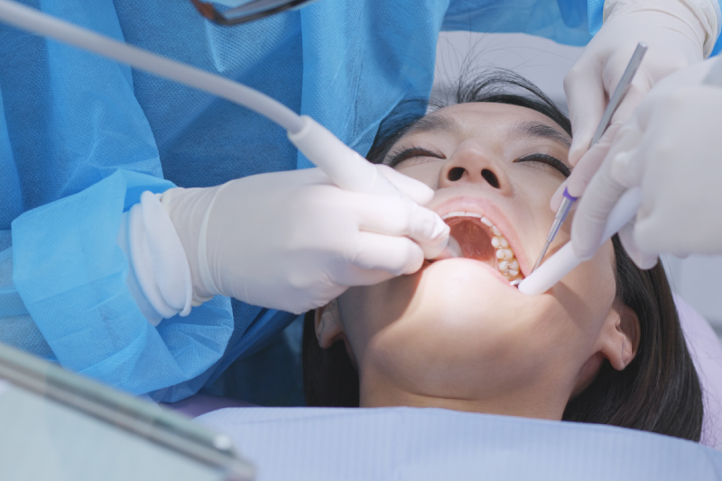 Scaling & Root Planing